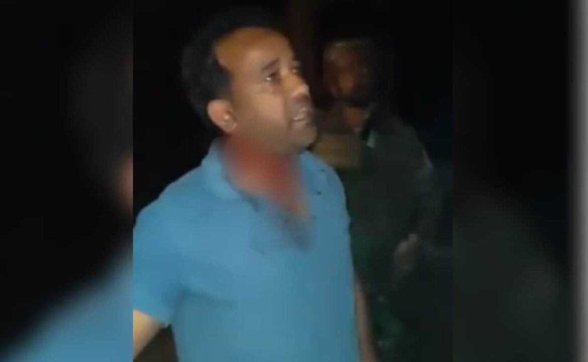 యూనివర్శిటీ ప్రొఫెసర్ J & K యొక్క రాజౌరిలో దళాలు దాడి చేసినట్లు యూనివర్శిటీ ప్రొఫెసర్ J & K యొక్క రాజౌరిలో దళాలు దాడి చేసినట్లు పేర్కొన్నారు, ఆర్మీ ఆదేశాలు దర్యాప్తు