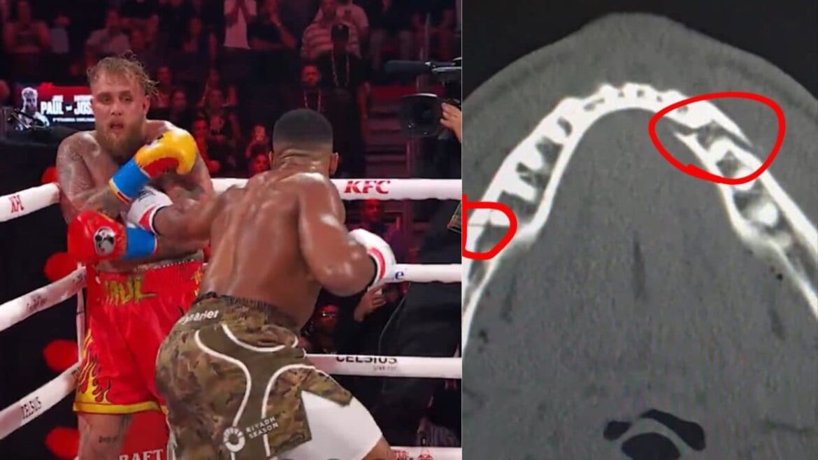 'గివ్ మీ కానెలో ఇన్...', Jests Jake Paul After Suffering Double Broken Daw Against Anthony Joshua | ఇతర-క్రీడా వార్తలు

